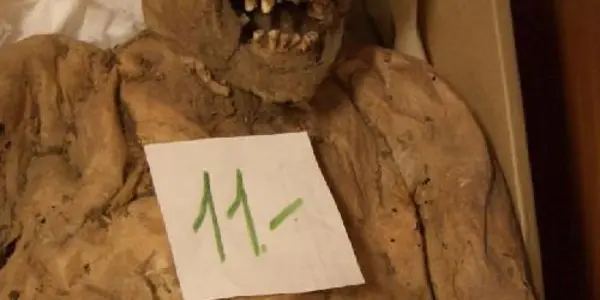 Mutated Gene Associated With Colon Cancer Discovered In 18th-century Hungarian Mummy