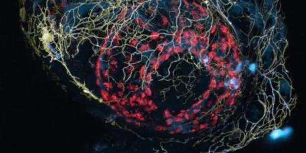 Transgenic,Transparent Zebrafish Shows Alzheimer's At Work In Brains