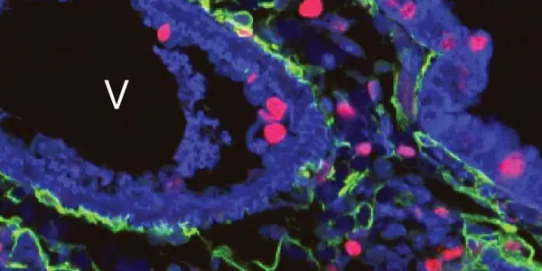 Pinpointing Gene That Regulates Repair And Regeneration In Adult Lungs