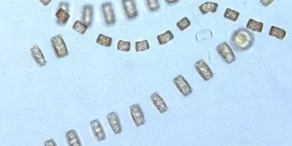 Spring Plankton Bloom Hitches A Ride On Ocean Eddies