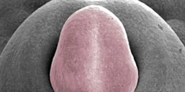 Bmp4: Why The Embryonic Chicken Penis Stops Growing