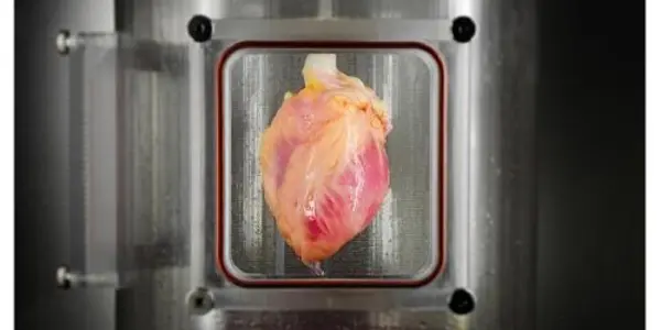 Functional Heart Muscle Regenerated In Decellularized Human Hearts