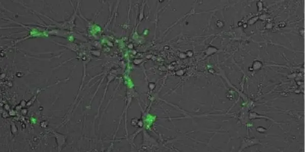 Certain Herpes Viruses Can Infect Human Neurons