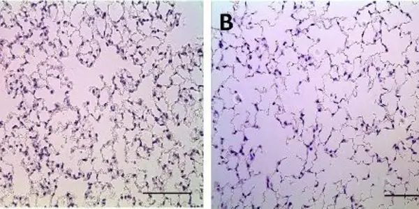 Baby's Breath: A New Way To Study Neonatal Lung Disease