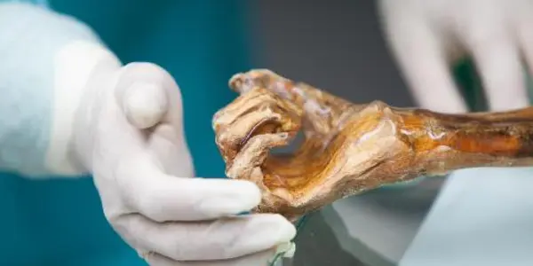 New Discoveries Concerning Ötzi's Genetic History