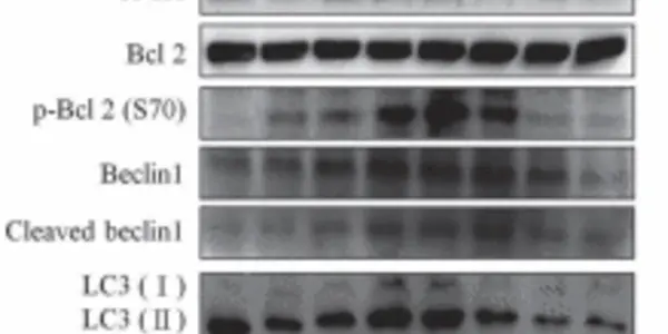 Cow's Milk Peptide Kills Human Stomach Cancer Cells