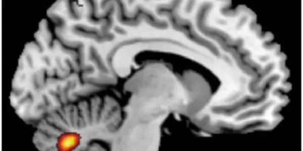 How Memory And Schizophrenia Are Connected