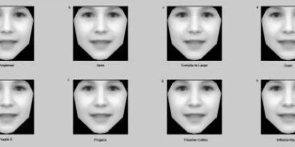 Computer Analysis Of Photographs Could Help Diagnose Rare Genetic Disorders