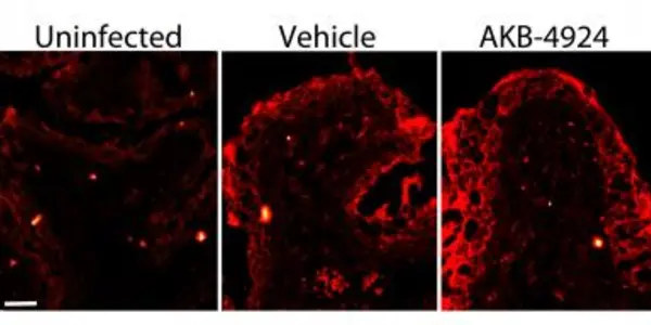AKB-4924 Experimental Drug Boosts Urinary Tract Ability To Fight Infections