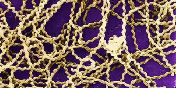 What Makes A Bacterial Species Able To Cause Human Disease?