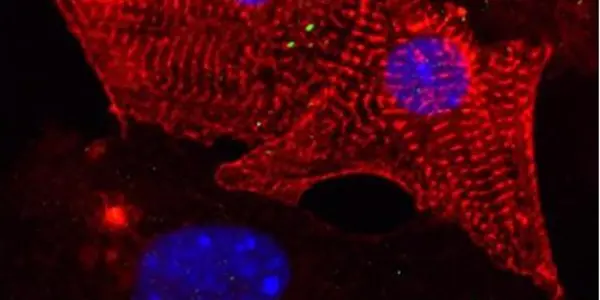 Scientists Discover How To Control Heart Cells Using A Laser