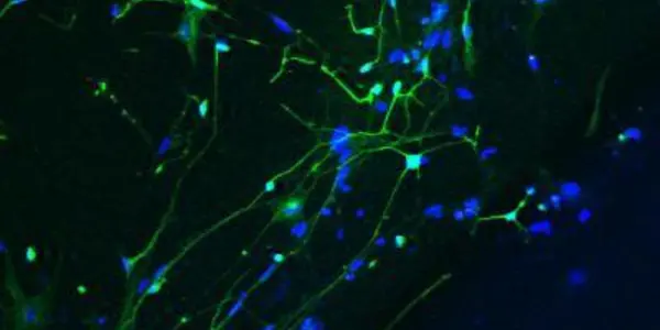 Functional Nerve Cells From Skin Cells