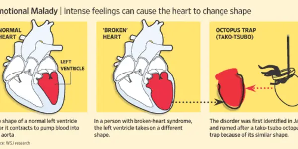 Broken Hearts: Not Just Fodder For Songwriters