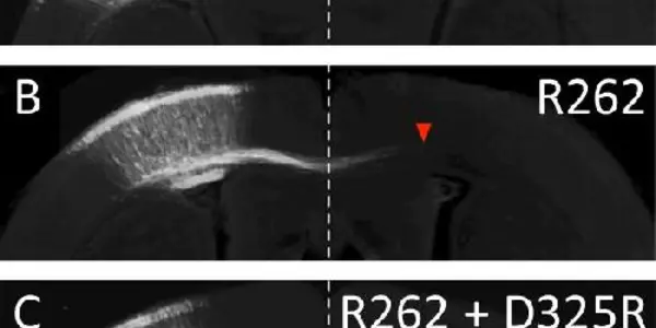 Thwarting Abnormal Neural Development With A New Mutation