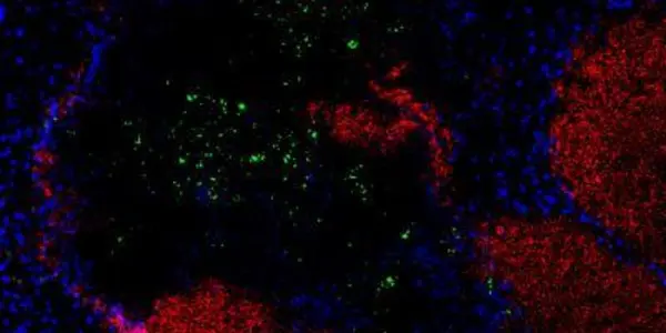 Natural Killer Cells: More Are Not Always Better