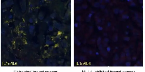 MLL1 Enzyme Key To Link Between Age-Related Inflammation And Cancer