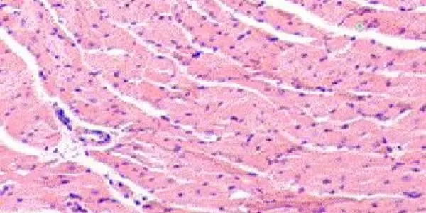 Infections Of The Heart With Common Viruses