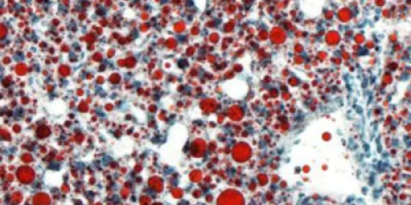 BAF60c Gene Turns Carbs Into Fat