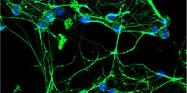 Mitochondrial Troublemakers Unmasked In Lupus