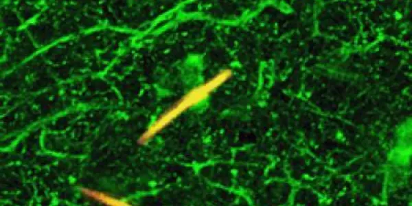 Brain Uses Serotonin To Perpetuate Chronic Pain Signals In Local Nerves