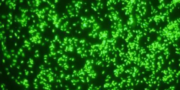 Bacteroides Ovatus Gut Bacterium A Crucial Part Of Our Daily Dietary Fiber Toolkit