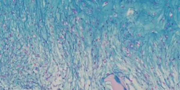 Bio-Engineers Grow Functional Human Cartilage In Vitro
