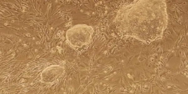 Cell Memory Loss Enables The Production Of Stem Cells