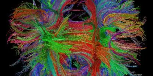 Pruning Brain Connections May Explain Why Girls Seem To Mature Faster