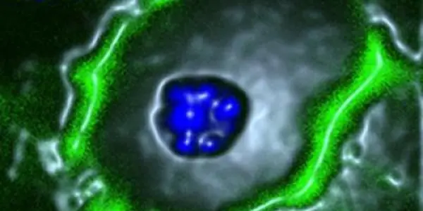 Fructose Block Prevents Fatty Liver Disease In Mice