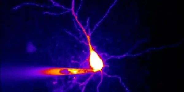 When The Neuron's Doorman Allows Too Much In