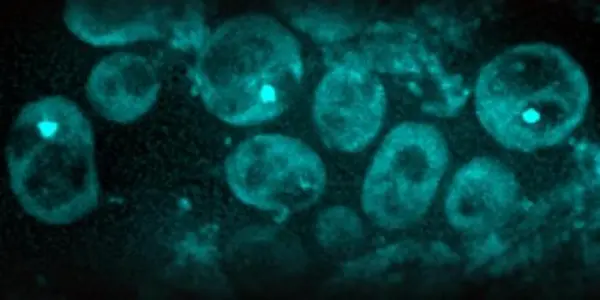 In Defence Of Pathogenic Proteins