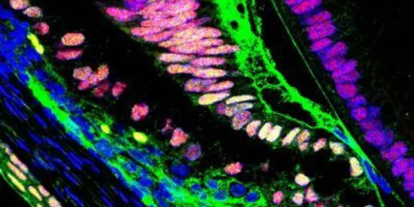Crosstalk Between Notch And Bone Morphogenetic Protein Signaling Pathways