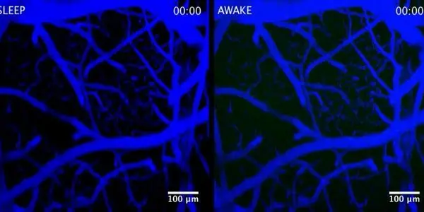 Brains Flush Out Toxins During Sleep?