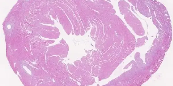 Two Proteins Control The Growth Of The Heart And Its Adaptation To High Blood Pressure