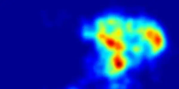 Waypoints To Consciousness: After Anesthesia, How Brains Restart With Everything Intact