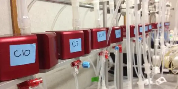 New Technique Reveals Causes Of Aging In Yeast