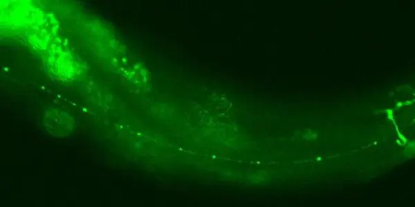 Tiny Worm Opens Big Discovery On Nerve Degeneration