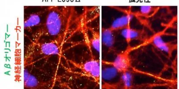 Alzheimer's Disease Modeled Using IPSCs