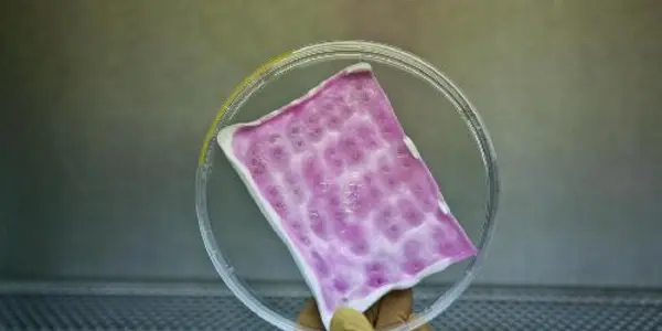 Infection-fighting Bandages For Serious Burns