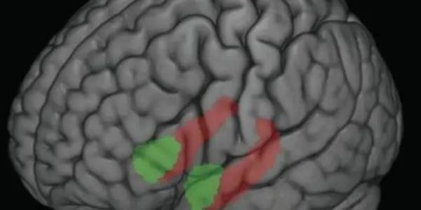 Early Life Stress Can Be Good For Developing Brains - Or Toxic