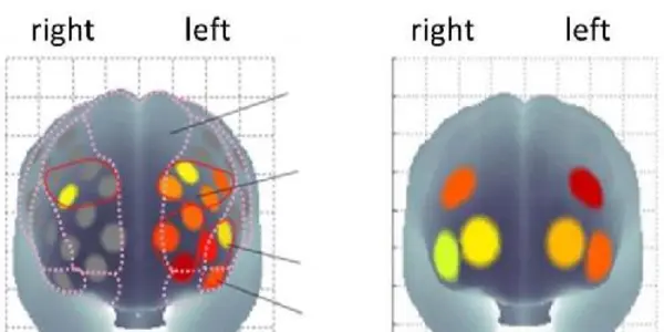 The Secret To Keeping A Younger Brain May Be Exercise