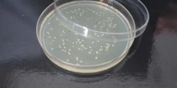 Why Are Bacteria Becoming Increasingly More Resistant To Antibiotics?