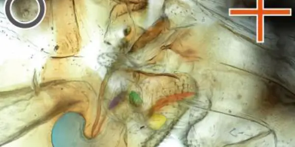 Sex Reversal: In Brazilian Cave Insects, Females Have The Penises