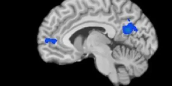 Brains Benefit From Meditation - Here's How