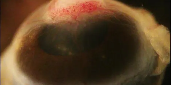 Eyes Turn Into Skin: How Inflammation Can Change The Fate Of Cells