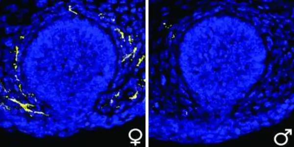 BDNF: His And Hers Mammary Gland Nerve Growth