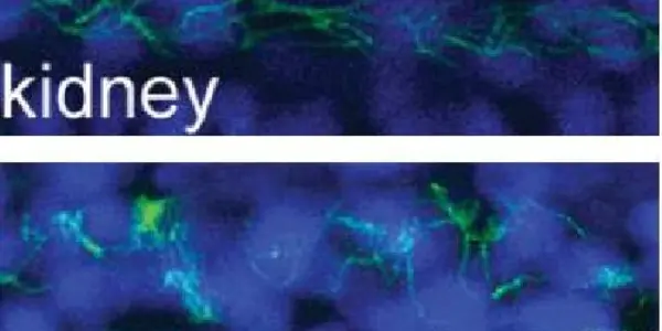 'Kurly' Protein Keeps Cilia Moving, Oriented In The Right Direction