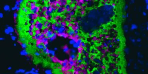 Open Gut Swimming: Fish Skin Immune Responses Resemble Those Of Stomach