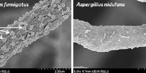 Avoiding Neutrophil Traps: How An Invasive Fungus Defeats The Mammalian Immune Response