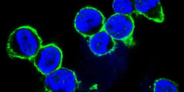 Disrupting Cell's Supply Chain Freezes Cancer Virus